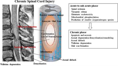 Current Concepts of Neural Stem/Progenitor Cell Therapy for Chronic Spinal Cord Injury